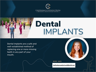 Dental Implant Gloucestershire
