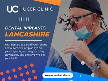 Dental Implants Lancashire