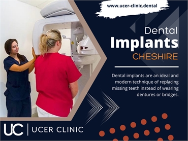 Dental Implants Cheshire