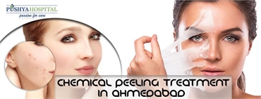 What Is Chemical Peeling Treatment Is It Safe To My Skin