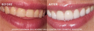Beverly Hills Holistic Dentist