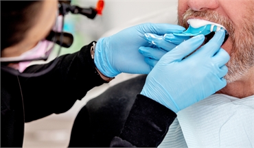 Dental assistant taking measurements for dental crown at Dentistry By The Bay Barrie ON