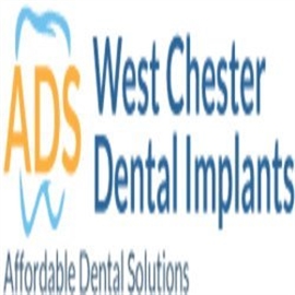 West Chester Affordable Dental Implants