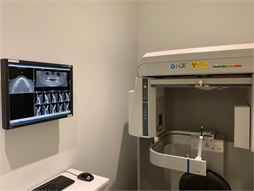 I-CAT CBCT Cone Beam system at Fayetteville dentist McQueen Dental
