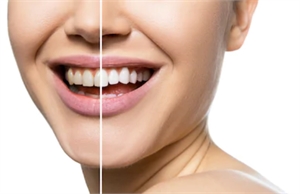 Look and Feel Good with These Easy Dental Hacks