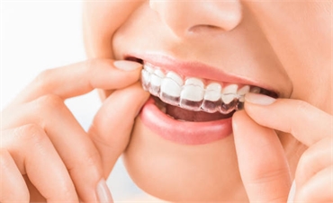 Top Benefits of Choosing an Invisalign Dentist in Burlington For Teeth Straightening