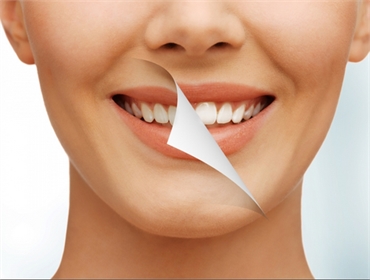 How a Smile Makeover Can Improve Your Life