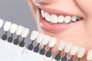 Teeth Whitening 101 Candidates Procedures and Maintenance