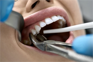 When Is Tooth Extraction Necessary