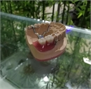 Chengdu DT dental lab