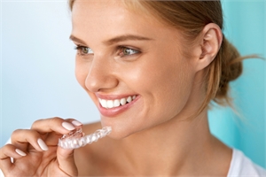 Orthodontics clear aligners by Dr. Suffoletta