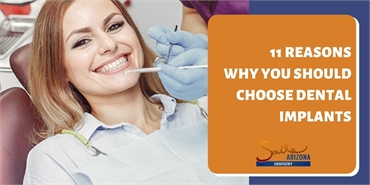 11 Reasons Why You Should Choose Dental Implants