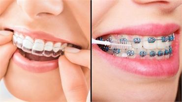 What is the difference between braces and Invisalign