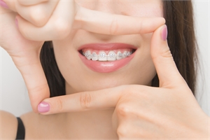 What to Expect in Your First Week with Braces