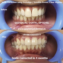 Geetanjali Dental Options