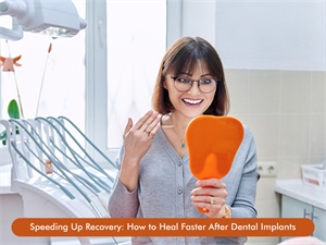 Speeding Up Recovery How to Heal Faster After Dental Implants
