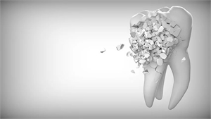 What Is Dental Malpractice