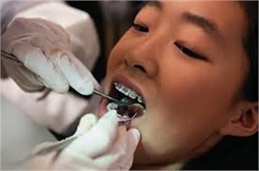 10 Factors To Consider Before Choosing A Dentist In Your City