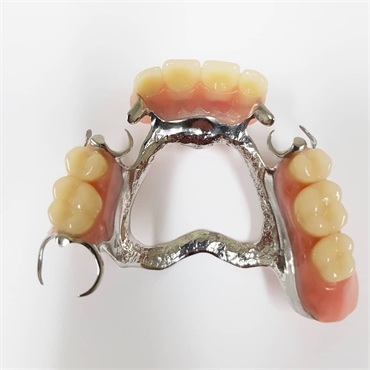 Partial Dentures Metal