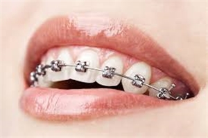 6 Fun Facts About Your Orthodontist