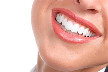 New Porcelain Veneers Have Many Smiling