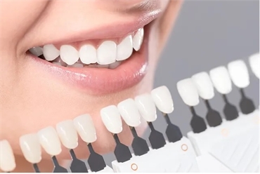 Everything You Need to know about Dental Veneers