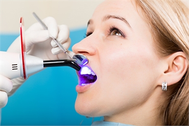 DENTAL IMPLANT IN ANCASTER ON